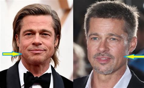 brad pitt before and after face lift